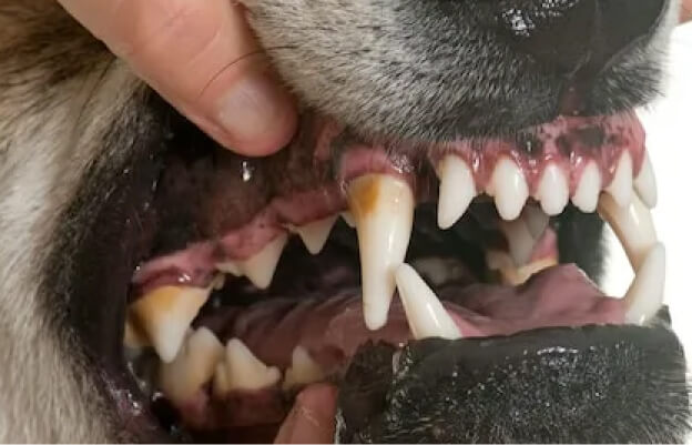 Иллюстрация микробов на воспаленных зубах